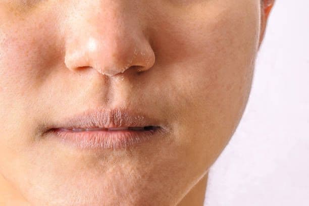 Kerutan Bibir Bikin 10 Tahun Lebih Tua? No way!